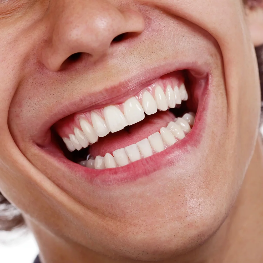 Szeroki, zdrowy uśmiech zadowolonego pacjenta jako efekt bezstresowego leczenia w kameralnej atmosferze gabinetu Dental-Wit.