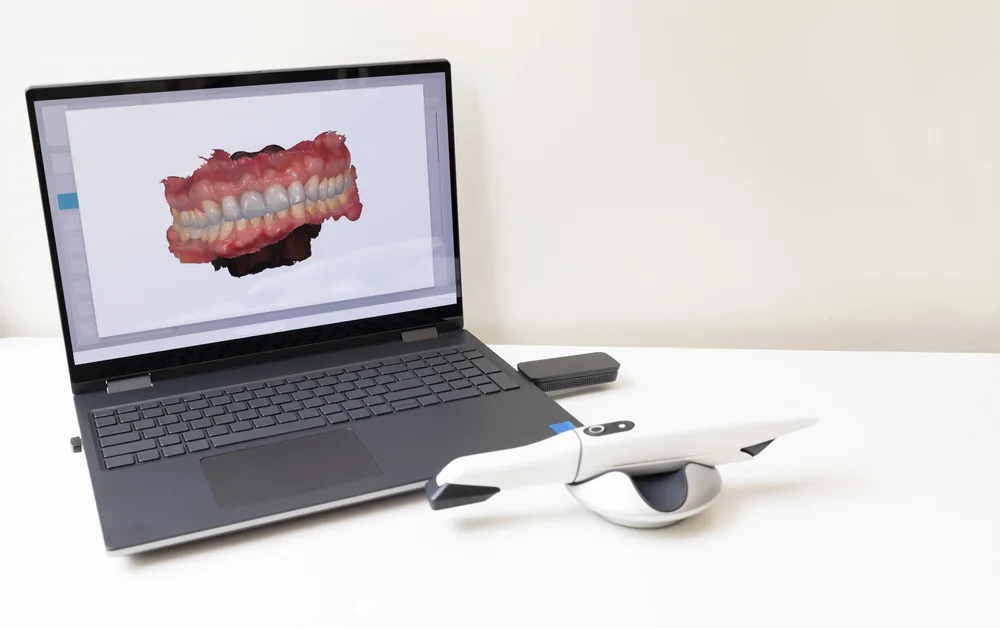 Skaner wewnątrzustny oraz laptop z wyświetlonym modelem 3D zębów pacjenta, używane w nowoczesnej stomatologii cyfrowej.