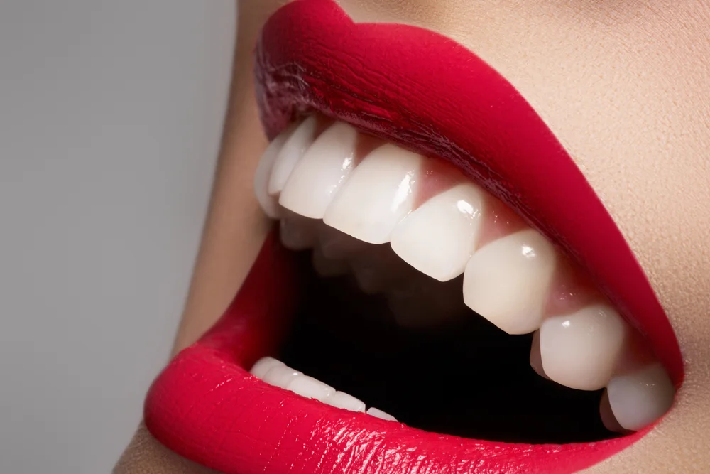 Zbliżenie na piękny, zdrowy uśmiech i białe zęby jako efekt profesjonalnych zabiegów stomatologii estetycznej w Dental-Wit.