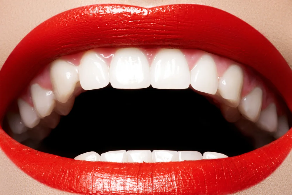 Zbliżenie na zdrowy i biały uśmiech po zabiegach stomatologicznych w gabinecie Dental-Wit w Będzinie